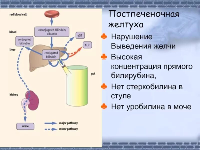 Норма непрямого билирубина в моче. Причины повышения билирубина в моче. Билирубин и уробилин в моче. Билирубин и уробилиноген в моче. Реакция на билирубин положительная