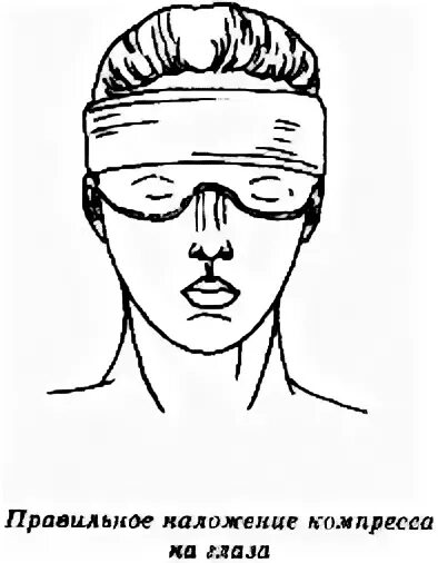 Техника наложения компресса. Холодный компресс. Скобки как накладывать. Холодный компресс животному при ушибе.