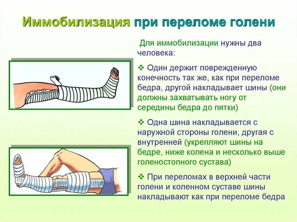 Закрытый перелом алгоритм. Транспортная иммобилизация при переломе голени. При переломе костей голени иммобилизируют. Транспортная иммобилизация перелома бедра алгоритм. Транспортная иммобилизация костный перелом голени.