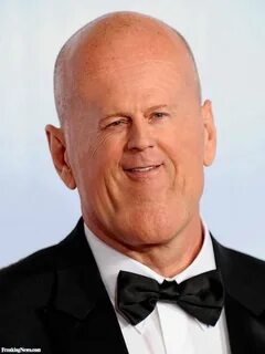 Large head