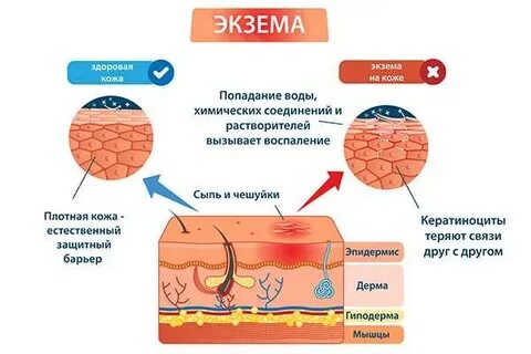 Наносят на кожу йод возникает местное