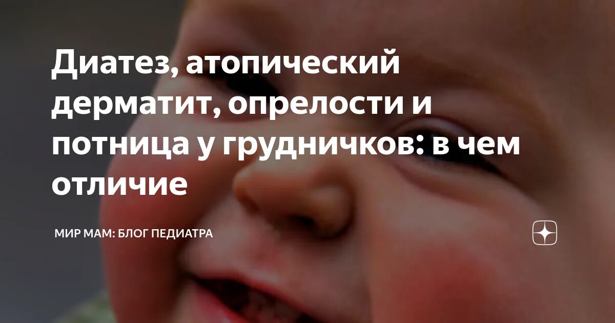 Потница у ребенка фото симптомы и лечение Потница на лице у грудничка