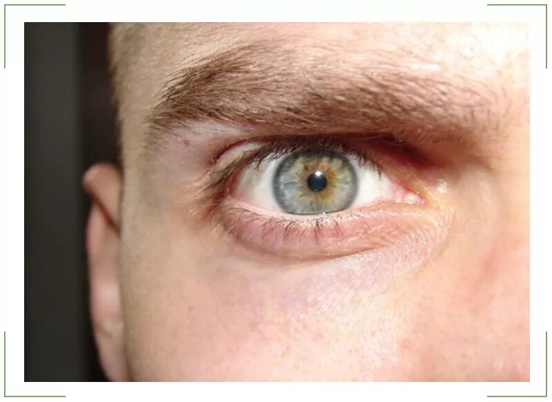 Интересные высказывания про глаза. Как видит глаз. Информация о глазах человека. Интересные факты о зрении. Заболевания глаз презентация.