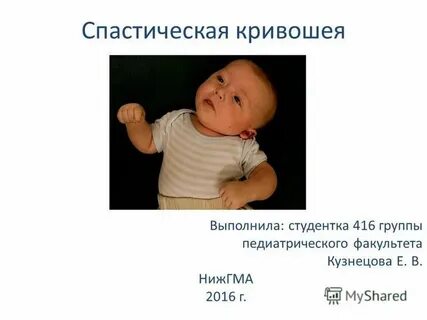 Спастическая кривошея