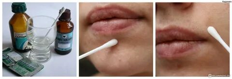 Борная кислота от прыщей на лице