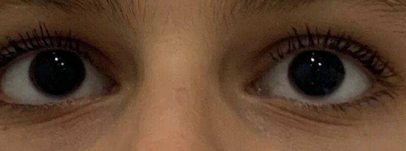 Нормальный зрачок и расширенный. Реквием по мечте кадры из фильма. Зрачки после наркоза. Зрачки после наркоза. Стадии эфирного наркоза таблица.