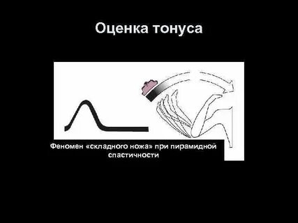 Зубчатый тонус