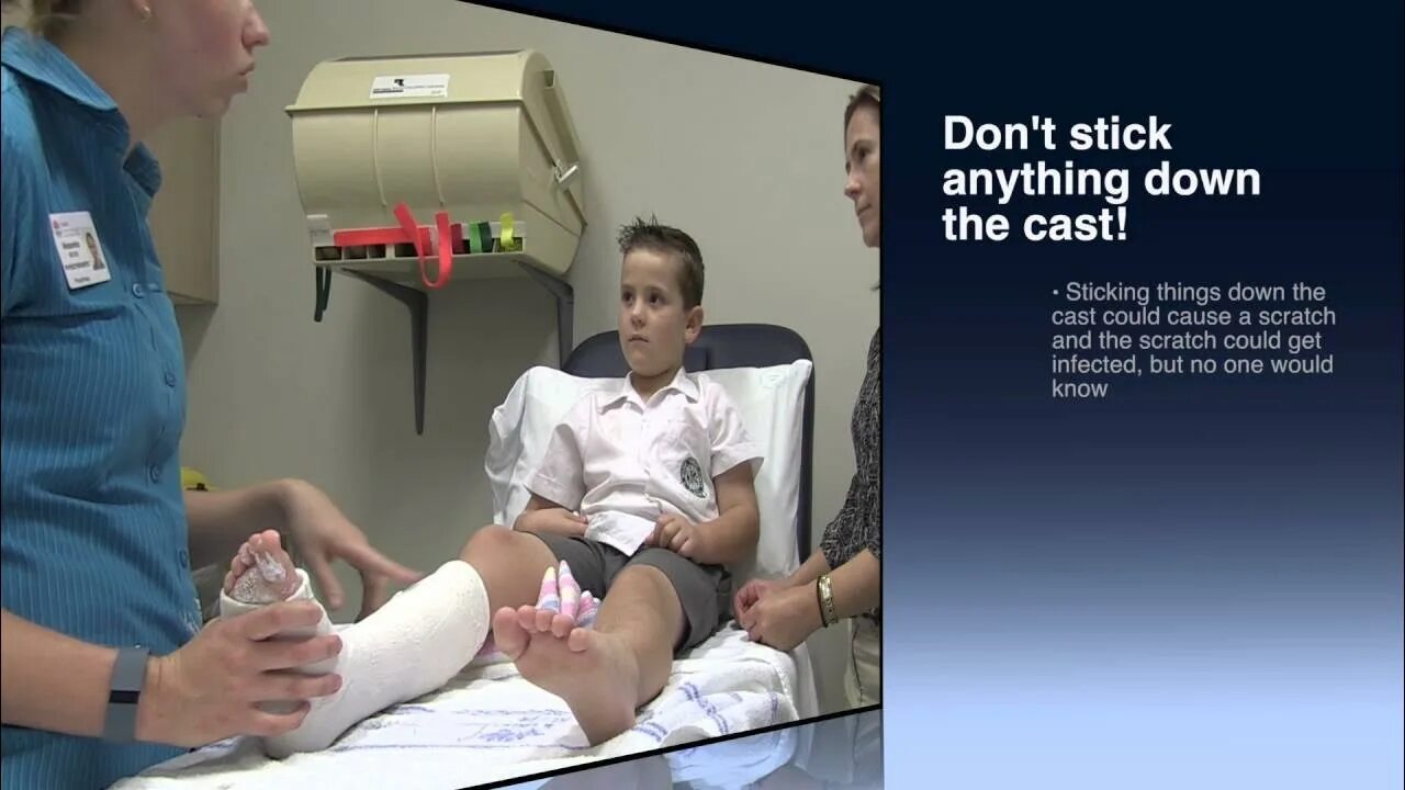 Having a cast