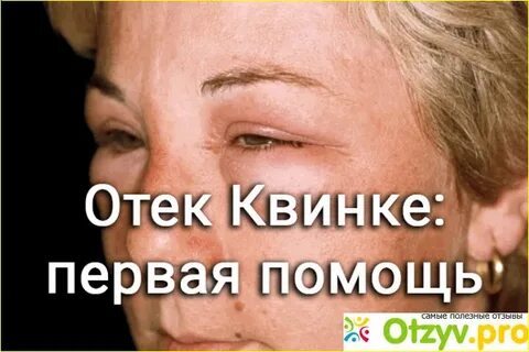 Внутренние отеки симптомы