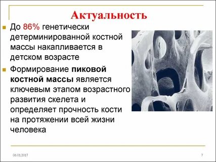 Костная масса