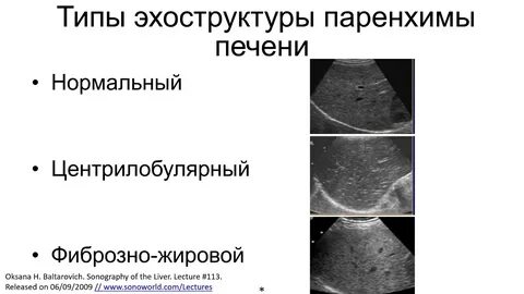 Умеренное изменение печени