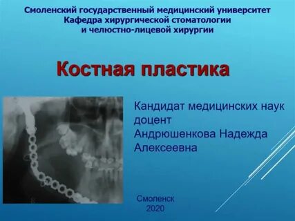 Костная пластика это