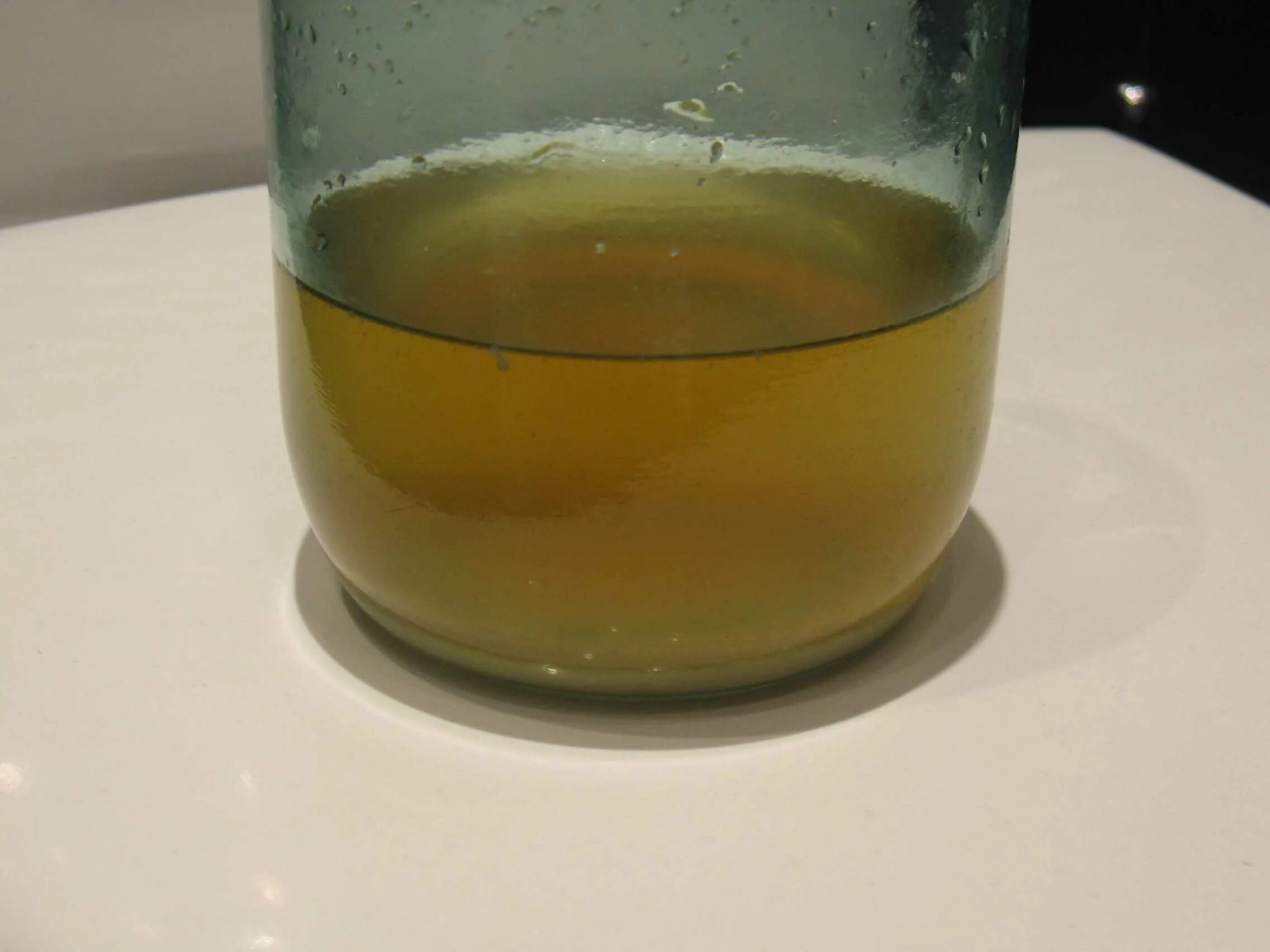 Белые хлопья в моче. Почему в моче белые хлопья. Хлопья в моче. Хлопьевидный осадок в моче. Белые хлопья в моче у женщин.