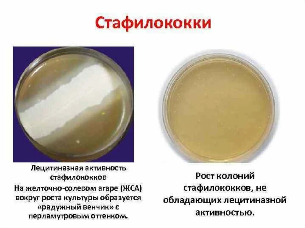 Лецитиназа на желточно солевом агаре. Желточно-солевой агар колонии стафилококка. Стафилококк на желточно солевом агаре. Радужный венчик стафилококка на ЖСА. Staphylococcus aureus среда