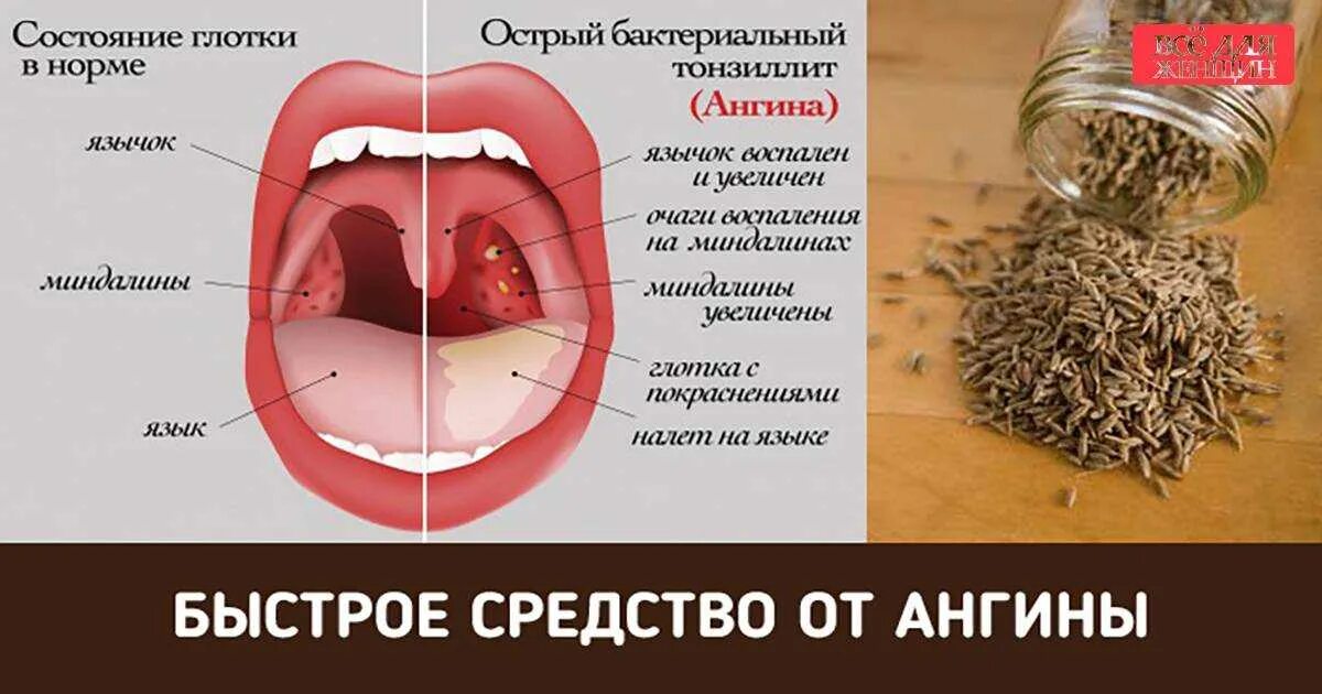 Как определить горло ребенку: найдено 89 изображений