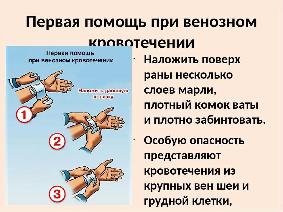 Первая помощь при венозном кровотечении. ПМП при артериальном и венозном кровотечениях. Что делать при венозном кровотечении. Первая помощь при венозногокровотечении.