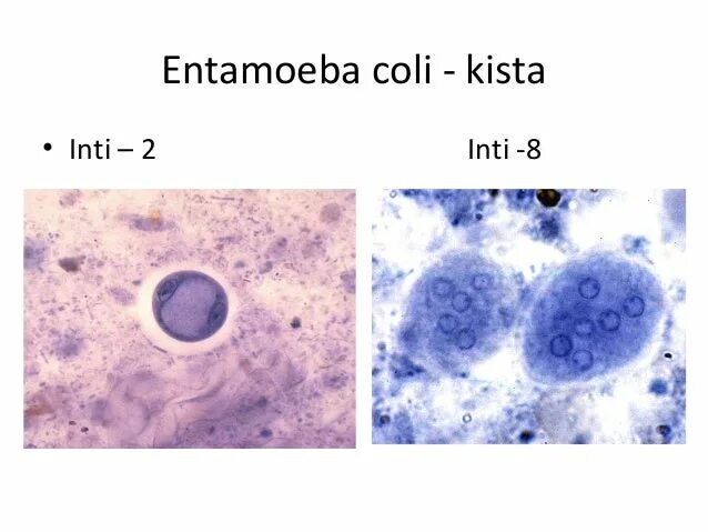 Entamoeba coli циста. Entamoeba histolytica жизненный цикл. Entamoeba coli жизненный цикл. Entamoeba coli в кале