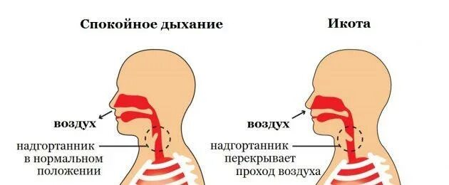 Чтобы быстро прошла икота. Методы избавления от икоты. как избавиться от икоты. от чего человек икает. как избавиться от икоты быстро.