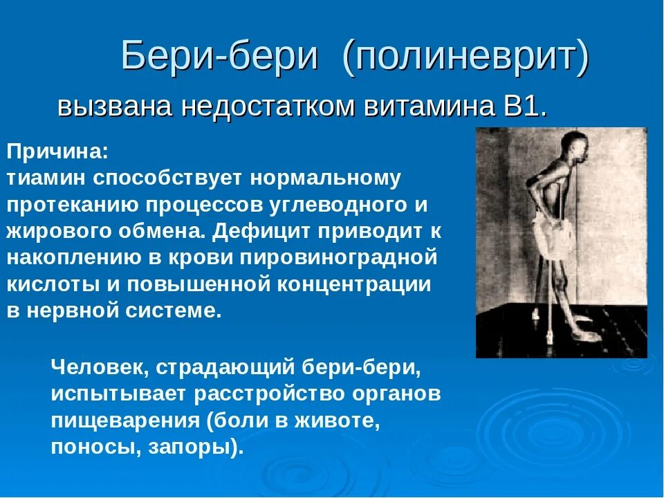 Недостаток витамина в1 бери бери. Алиментарный полиневрит. При недостатке заболевание бери бери