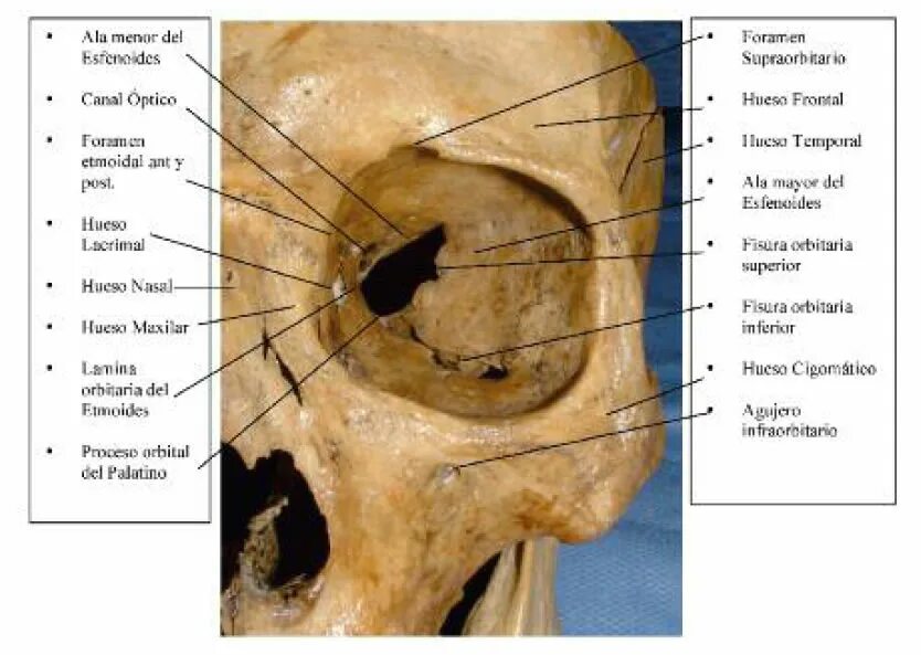 Левой глазницы. Орбита глазница анатомия. Глазница черепа анатомия. Костные стенки глазницы анатомия. Медиальная стенка глазницы анатомия.
