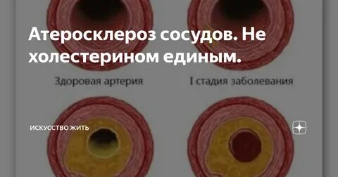 Проверить бляшки