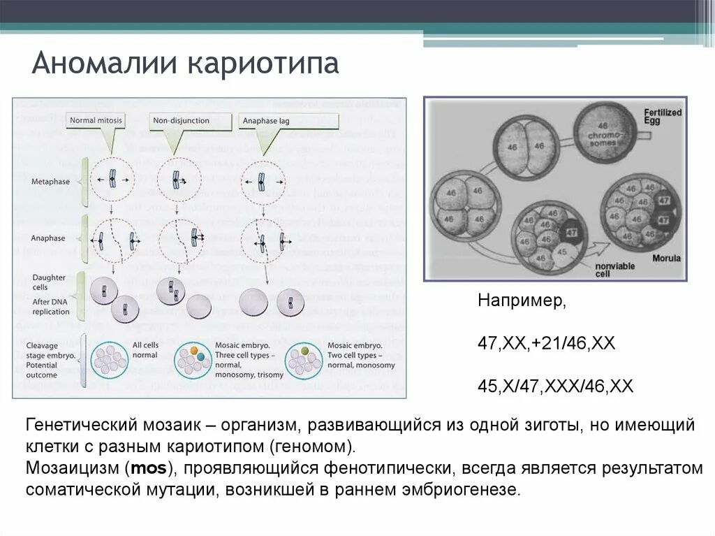 В зиготе человека содержится количество хромосом. Аномалии кариотипа. Исследование кариотипа. Аномальный кариотип. Аномалии кариотипа человека.