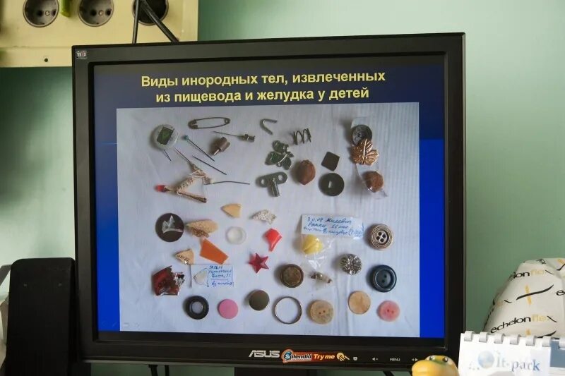 Предметы которые достают из. Предметы извлеченные из желудка. извлеченные инородные тела.