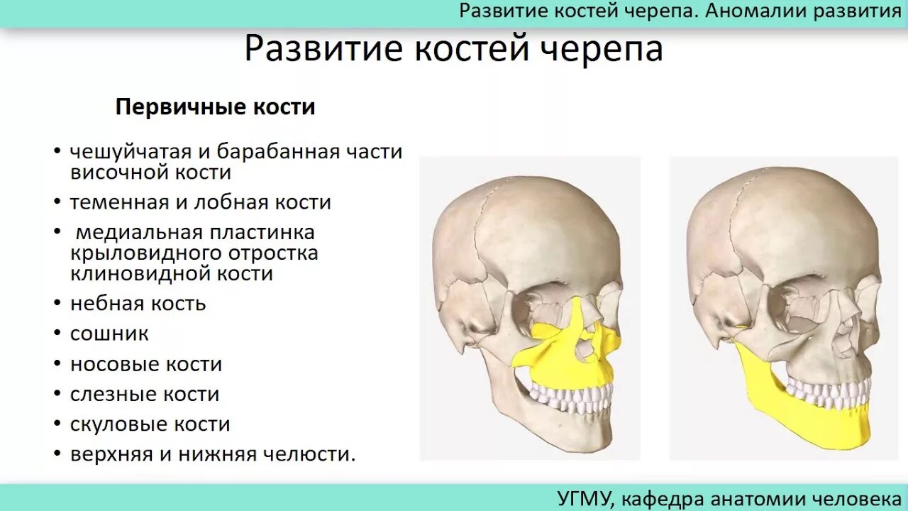 Черепная аномалия. Аномалии развития черепа анатомия. Первичные и вторичные кости черепа. Аномалии развития костей черепа. Патологии развития костей черепа.