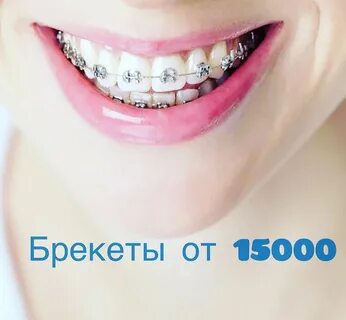 Брекеты красноярск