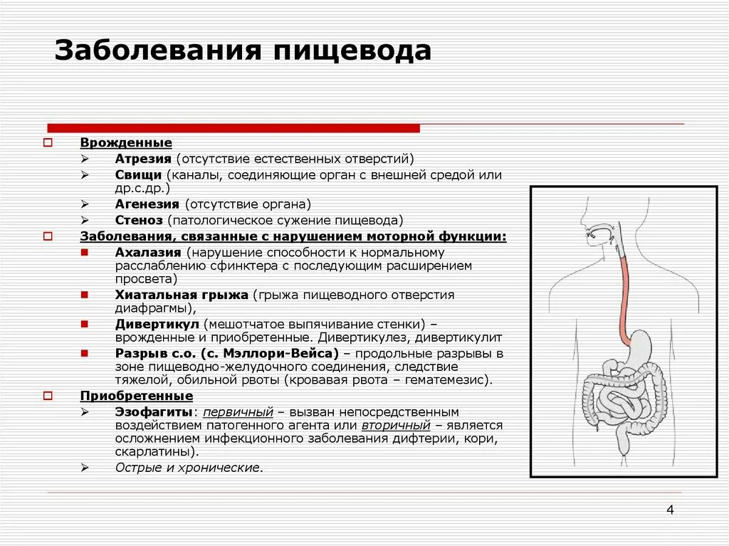 Какая болезнь пищевода