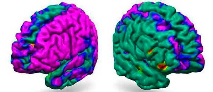 Биоэлектрическая активность мозга. Датчики биоэлектрической активности мозга. Диффузные изменения мозга. Диффузия супрессия биоактивности головного мозга.