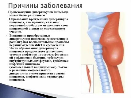 Больно пищевод