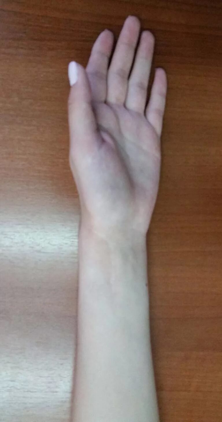 Древесная пыль на руке. Как выглядит рука после. Как выглядит рука после. Поломанная рука без гипса. Бактерии под ультрафиолетом.