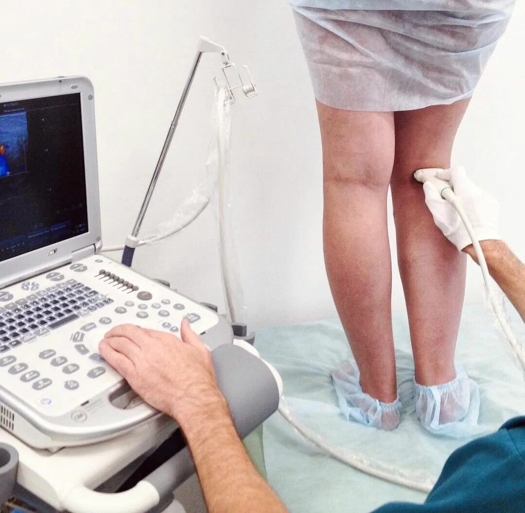 пройти уздг нижних конечностей. ультразвуковая допплерография сосудов нижних конечностей. уздг сосудов вен нижних конечностей. уздг сосудов вен нижних конечностей. ультразвуковая допплерография сосудов верхних конечностей.