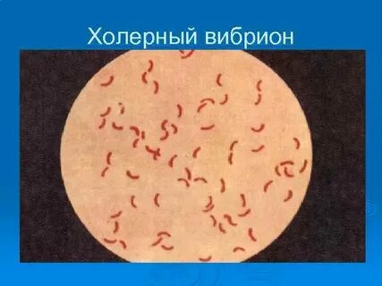 Возбудитель название