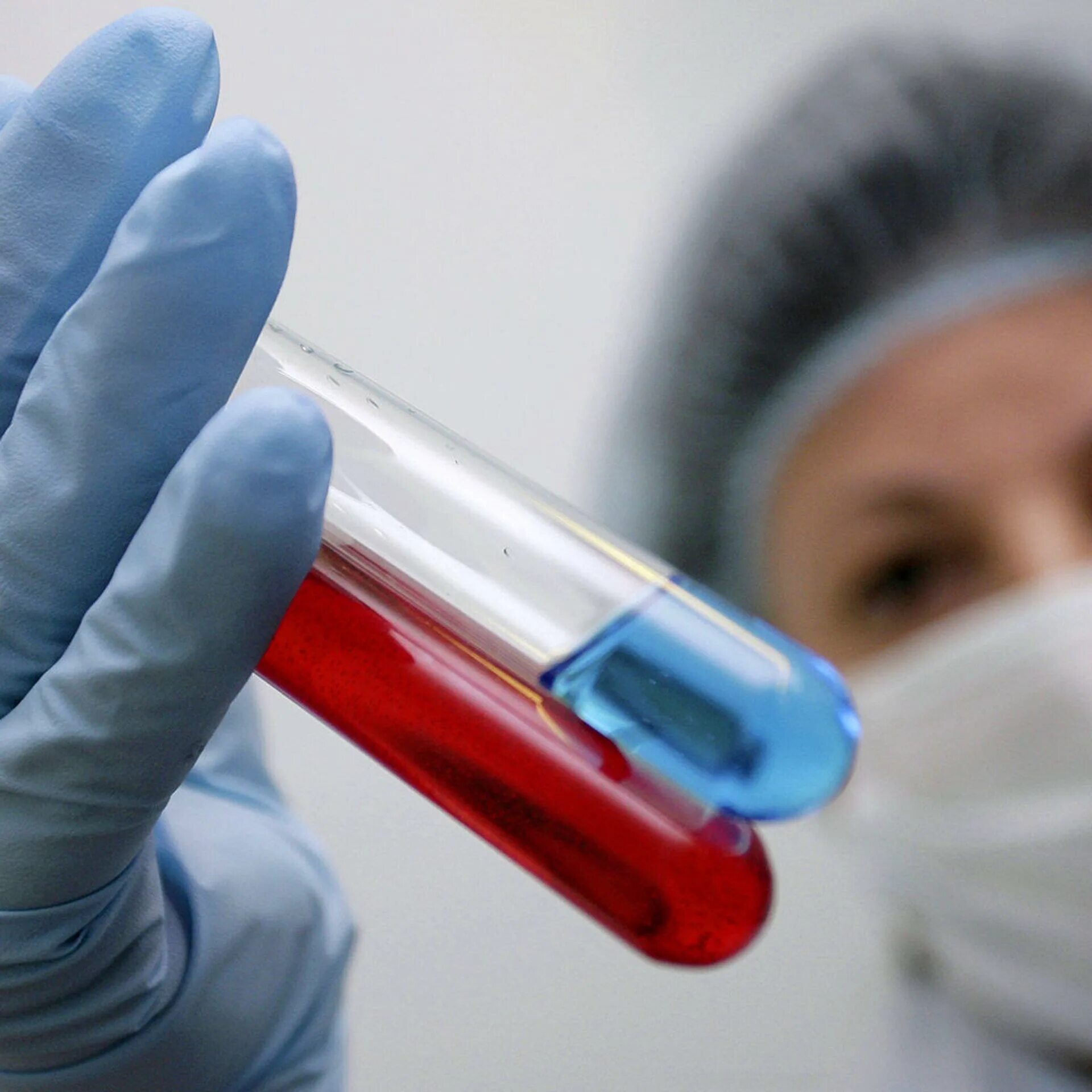 Врач вич инфекции. Врач ученый. Врач вич инфекции. Врач с красной лентой. Лекарство от спида.