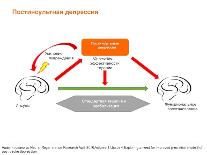 Постинсультная депрессия. Постинсультная депрессия терапия. Стандартная постинсультная терапия постинсультная.