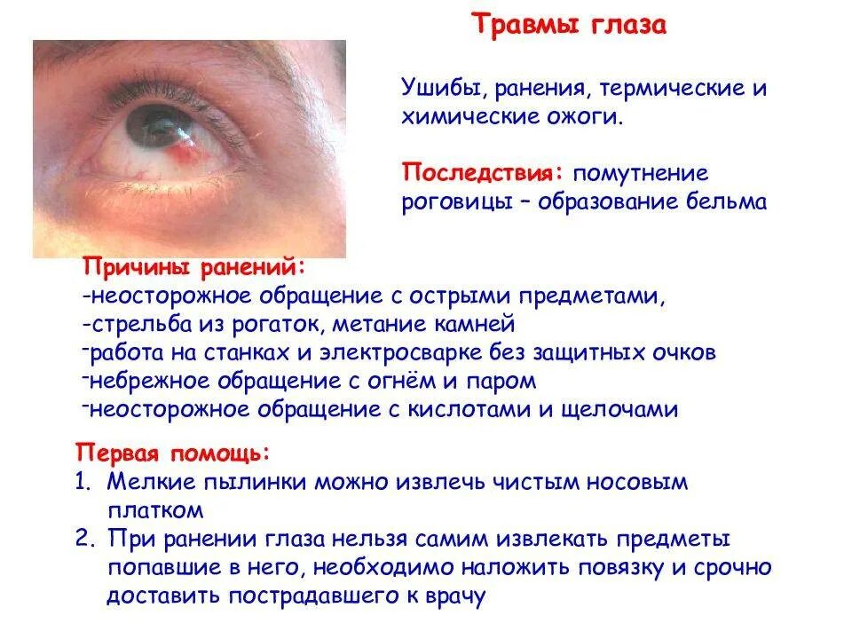 Не видно что попало в глаз. Предупреждение глазных болезней. заболевания и повреждения глаз. презентация болезни глаз.