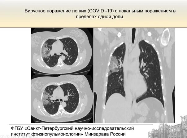 80 процентов поражение