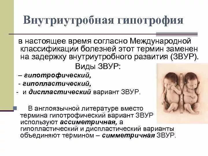 Степени у новорожденных. Звур 2 степени у новорожденных. внутриутробная гипотрофия. внутриутробная гипотрофия степени. задержка внутриутробного развития звур.