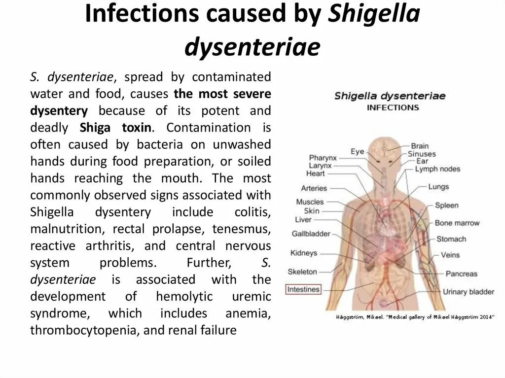 Shigella dysenteriae (шигелла дизентерия). Для s.dysenteriae характерно. Shigella dysenteriae таблица. Укажите Токсин Shigella dysenteriae:.