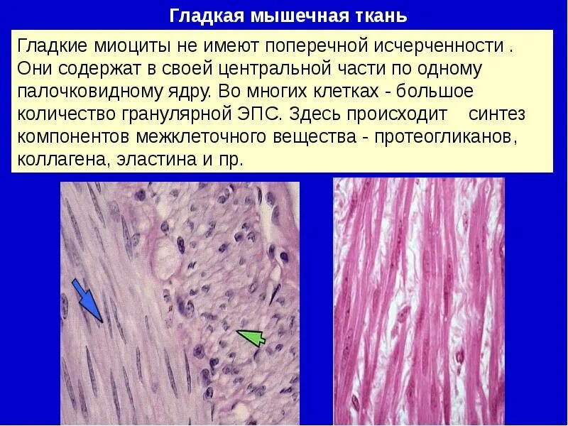 Состоит из клеток имеющих поперечную исчерченность. Межклеточное вещество гладкой мышечной ткани. Строение гладкой мышечной ткани межклеточное вещество. Гладкая мышечная ткань гладкие миоциты. Поперечная исчерченность гладкой мышечной.