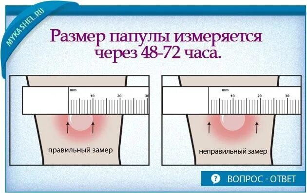 Через сколько дней проверяют манту у ребенка. Нормальный размер манту.