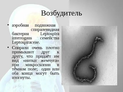 Лептоспироз возбудитель