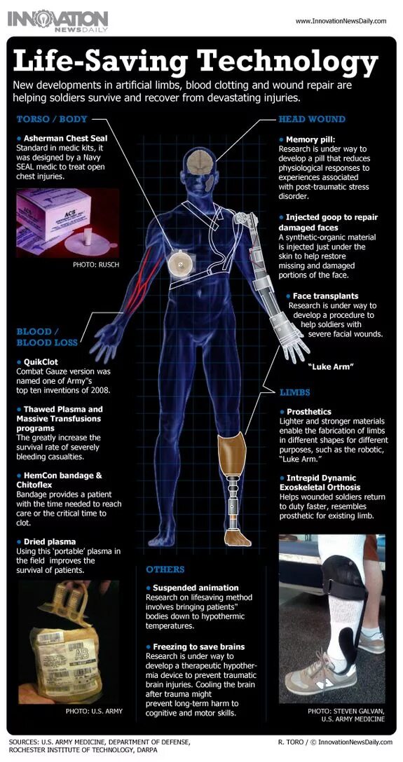 Artificial body