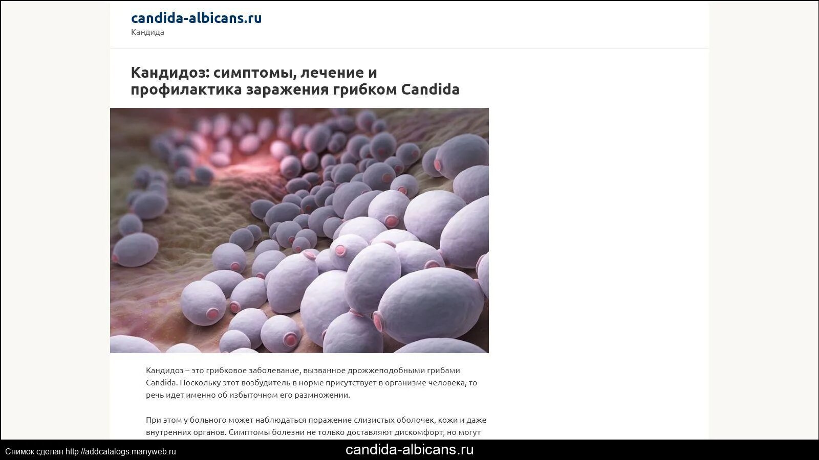 Грибы рода кандида (кандидоз). Кандида грибок микробиология. Чего боится грибок кандида. Чего боится грибок кандида. Дрожжеподобными грибками рода candida.