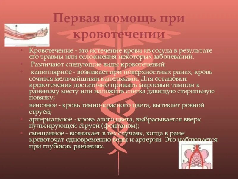 Первая помощь при кровотечениях таблица. Кровоточащая рана первая помощь. первая помощь при кровотечениях. таблица оказание первой помощи при кровотечении. таблица по первой помощи при кровотечениях.