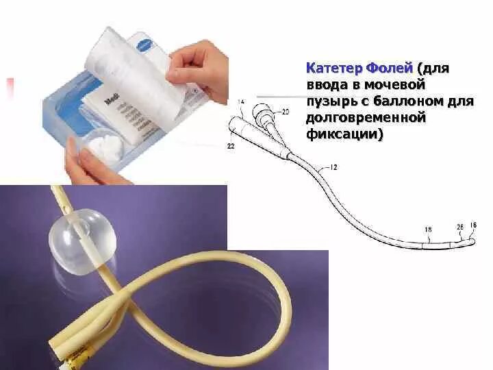 Уход за катетером фолея алгоритм. Мочеотводной катетер. Эпицистостома катетер. Мочевые уретральные катетеры. Цистостома мочевого пузыря катетер.