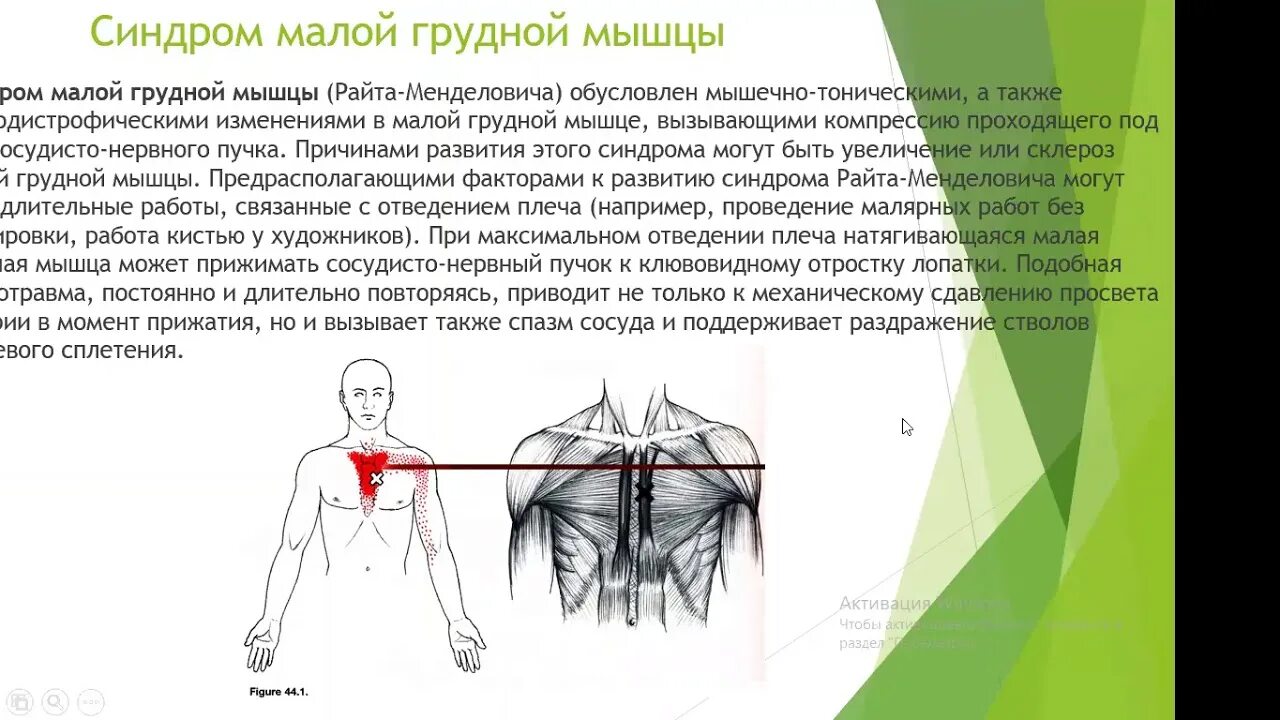 Туннельный синдром малой грудной мышцы синдром Райта Мендловича. Туннельный синдром малой грудной мышцы. Туннельный синдром малой грудной мышцы синдром. Симптом малой грудной мышцы симптомы.