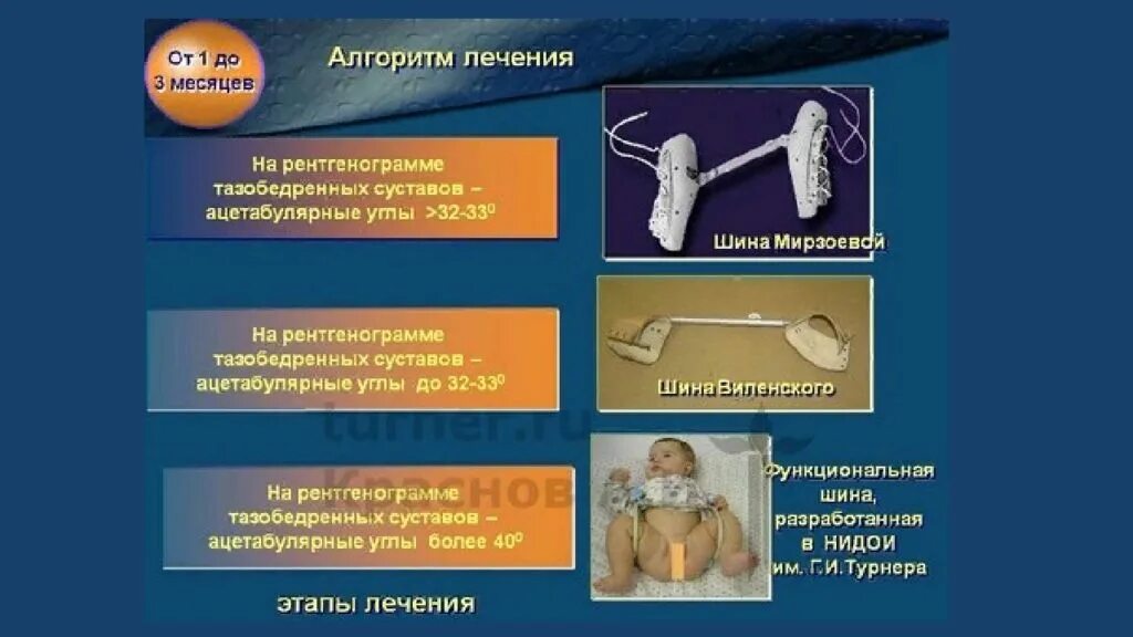 Врожденный вывих бедра - презентация онлайн